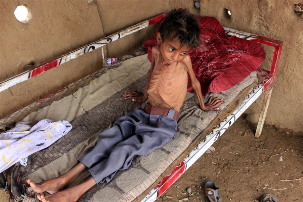 لصوص “العمل الإنساني” في اليمن: أموال أكثر… إغاثة أقلّ